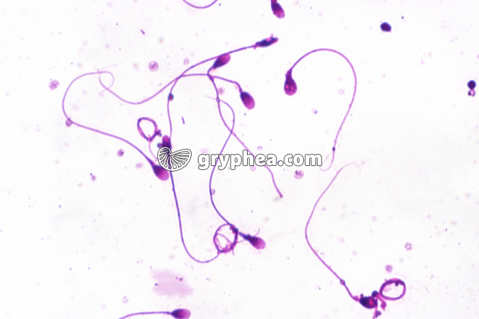 Spermatozoïdes humains x 320 - gryphea.com